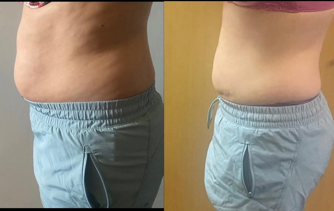 How To Lose 10 Pounds Fat